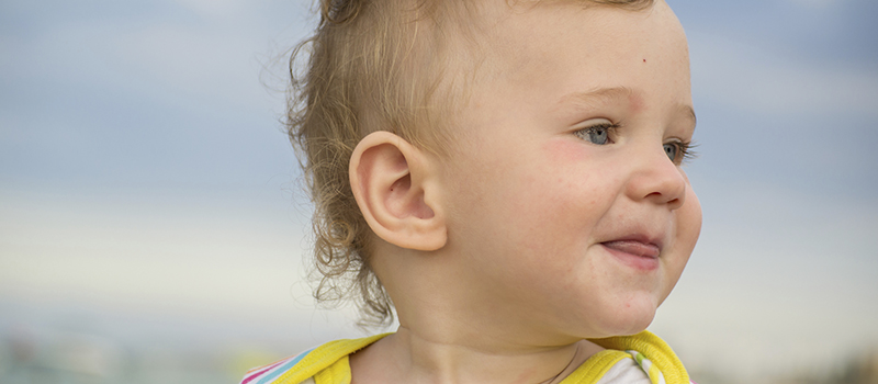 Small child with redness on the skin from food allergies